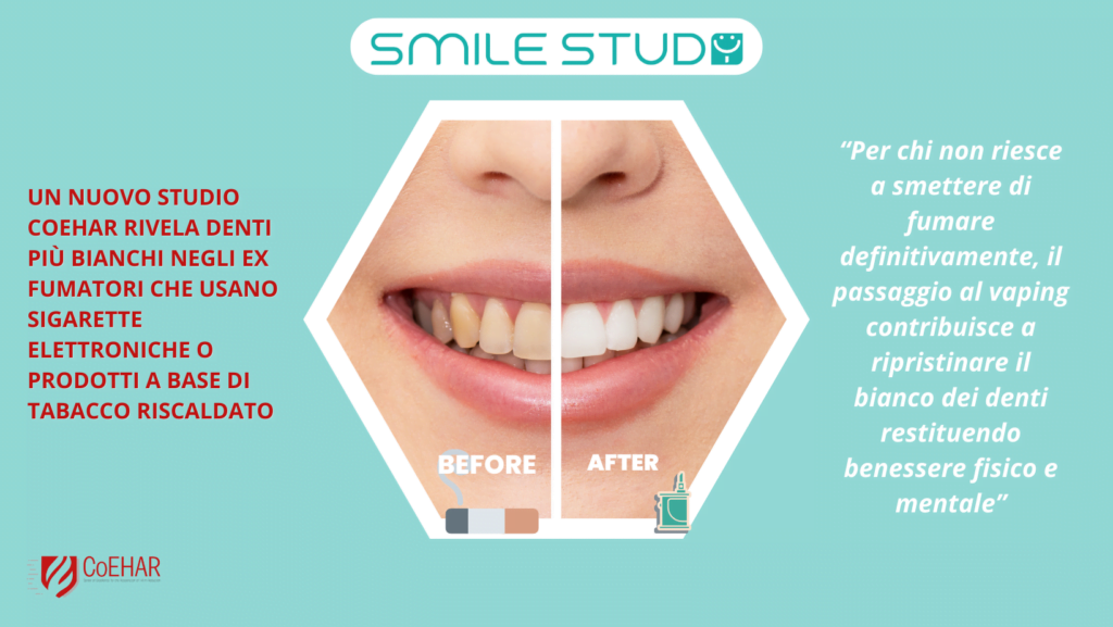 denti smile study