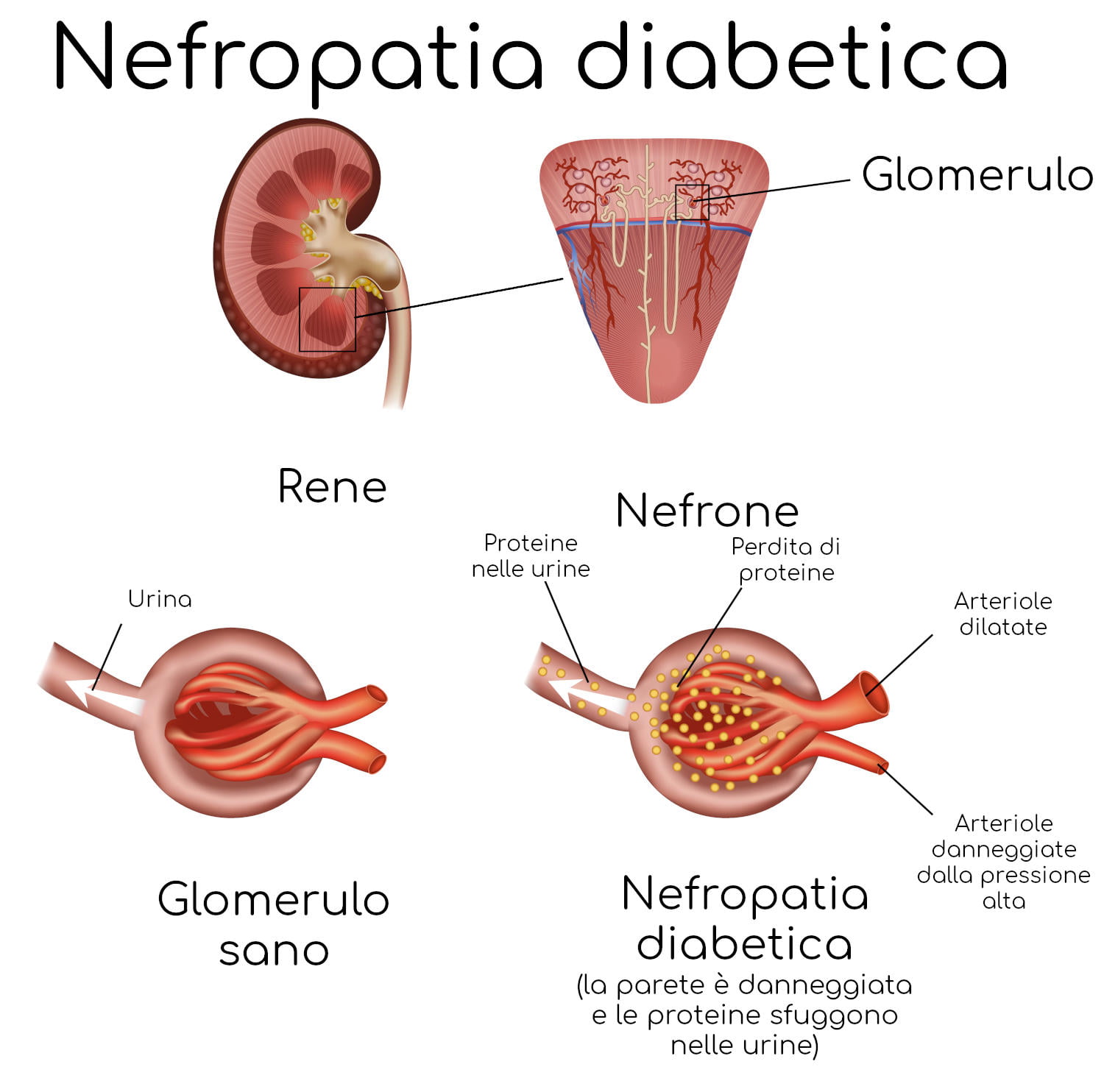 Scopri di più sull'articolo DIABETE MELLITO: UNO STUDIO EVIDENZIA LA NECESSITA DELLO SCREENING DELLA FUNZIONE RENALE PER EVITARE LE COMPLICANZE DELLA MALATTIA 